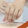 Jiahui Health Acupuncture or Tui Na Massage with 90% Off on SmartShanghai